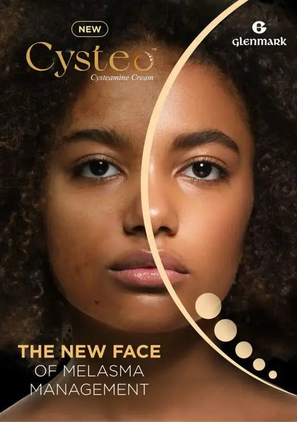 Cysteo Intensive Depigmentation Cream 15g | Cysteo | AbsoluteSkin