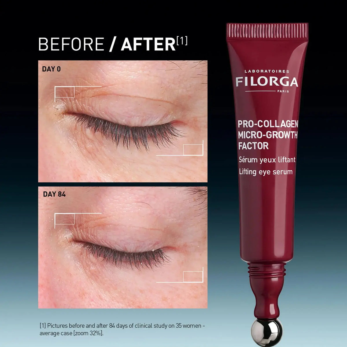 FILORGA Pro Collagen Micro Growth Eye Serum 15ml | Filorga | AbsoluteSkin