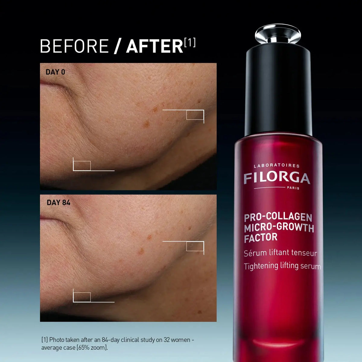 Filorga Pro-Collagen Micro-Growth Factor serum bottle shown beside before-and-after skin photo panels demonstrating a tightening effect on the jawline.