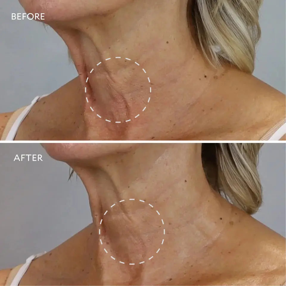 GATINEAU Age Benefit Neck and Decollete Cream 50ml | GATINEAU | AbsoluteSkin