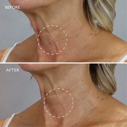 GATINEAU Age Benefit Neck and Decollete Cream 50ml | GATINEAU | AbsoluteSkin