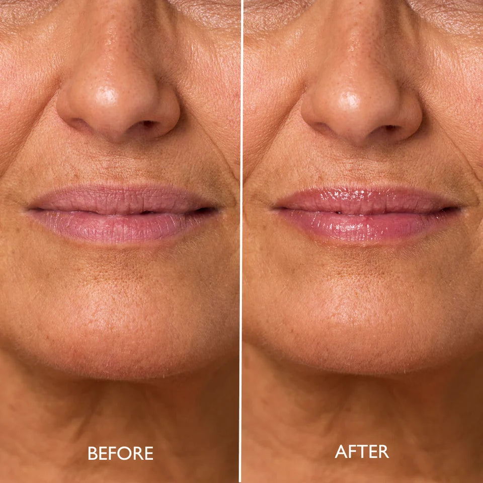 GATINEAU Defi Lift Peptide Lip Treatment Glow 10ml | GATINEAU | AbsoluteSkin