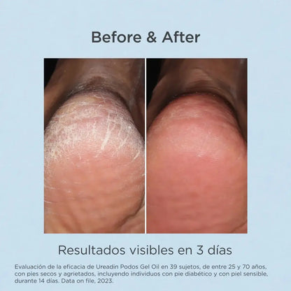 ISDIN Ureadin Podos Gel Oil 75ml | ISDIN | AbsoluteSkin