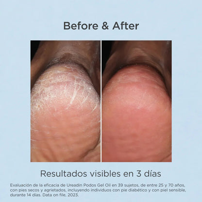 ISDIN Ureadin Podos Gel Oil 75ml | ISDIN | AbsoluteSkin